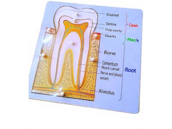 פאזל חלקי השן